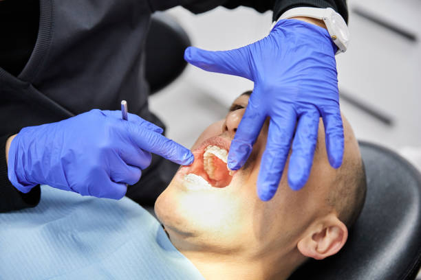 Best Broken Tooth Emergency  in Bronte, TX